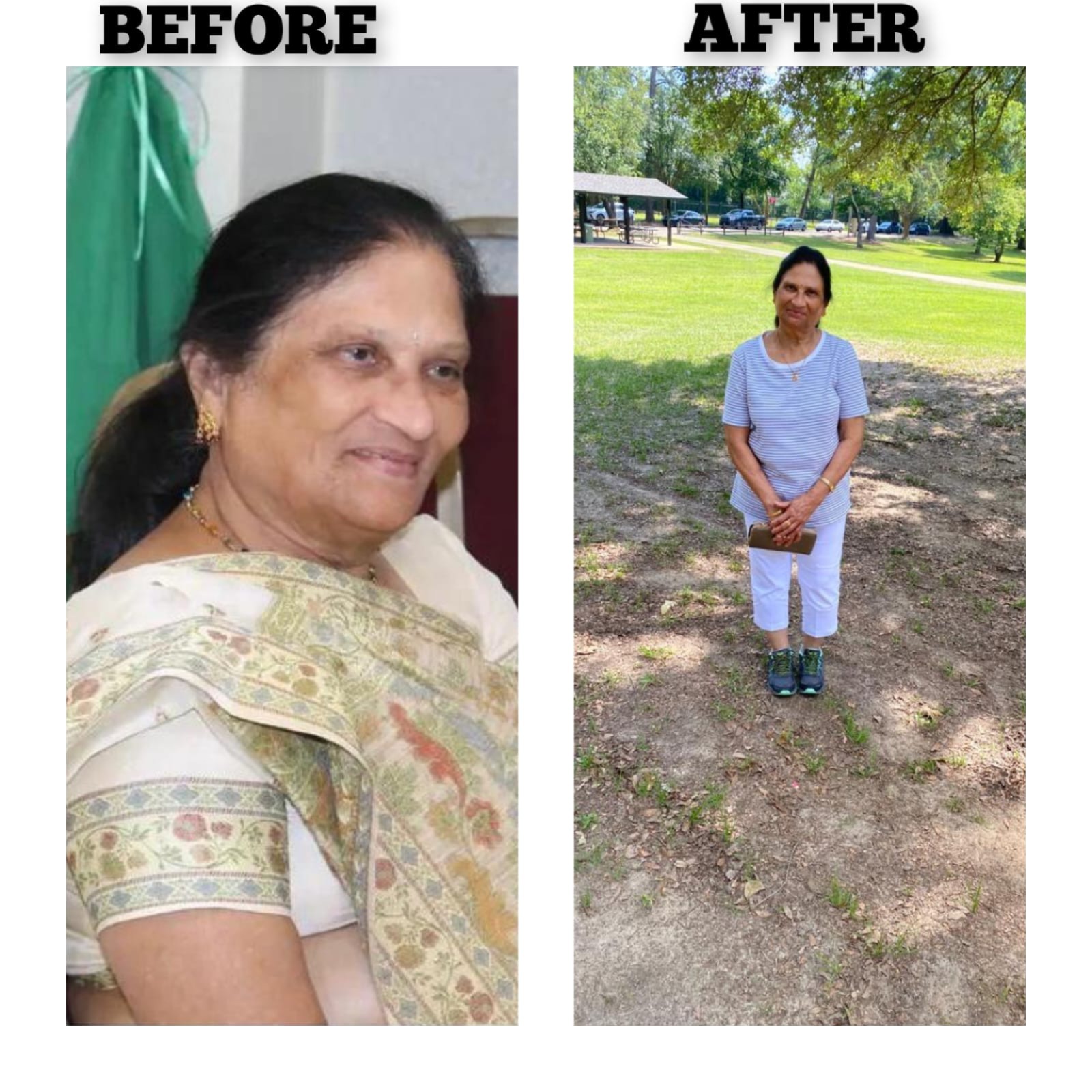 Weight Loss Treatment